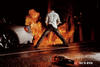 burn1