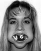 balls-in-mouth.jpg